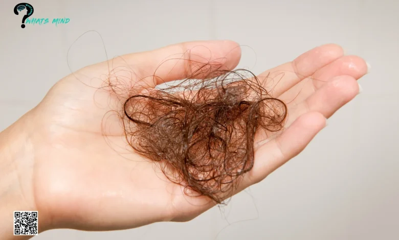 Hair Loss in Men and Women