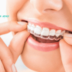 A Quick Guide on the Average Cost of Invisalign