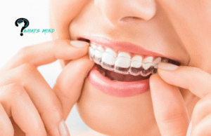 A Quick Guide on the Average Cost of Invisalign