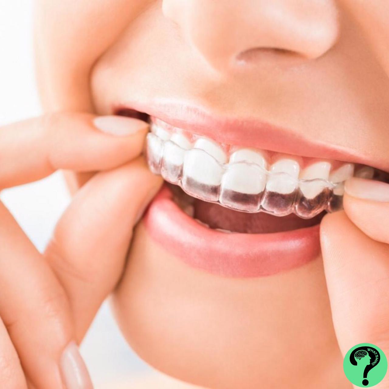 A Quick Guide on the Average Cost of Invisalign