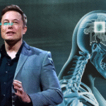 Rajkotupdates.News : Elon Musk In 2022 Neuralink Start To Implantation Of Brain Chips In Humans