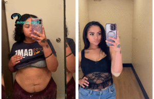 Astonishing Weight Loss Results of Mounjaro Before and After Pictures