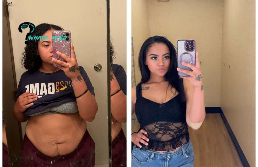Astonishing Weight Loss Results of Mounjaro Before and After Pictures
