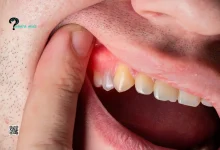 How to Kill Tooth Pain Nerve In 3 Seconds Permanently? Symptoms, DIY Remedies & Professional Treatments