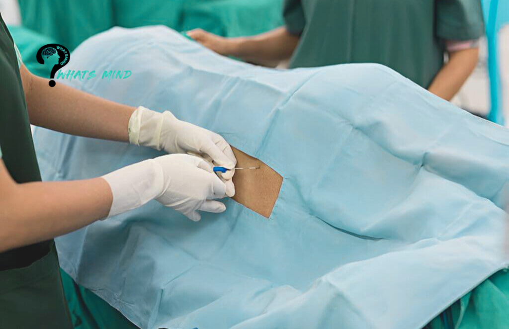 Dark Side Of Epidural Steroid Injection: How It Works, Possible Complications, Risk Prevention 