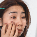 What Is Commonly Misdiagnosed As Pink Eye? Conjunctivitis, Myths, Preventive Measures & Doctor’s Consultation