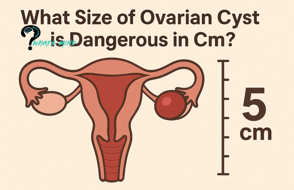 What Size of Ovarian Cyst is Dangerous in Cm?